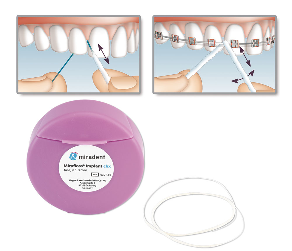 Mirafloss Implant CHX Οδοντικό Νήμα Fine 1.8mm ροζ
